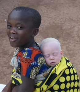 Photo of albino infant with mother at Kabanga